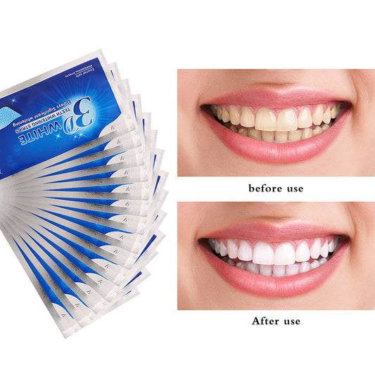 Teeth Whitening Strips – Flexible, Non‑Slip Whitening Strips for Home Use